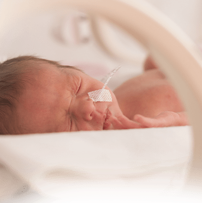 A sleeping baby with a medical tube on its nose.