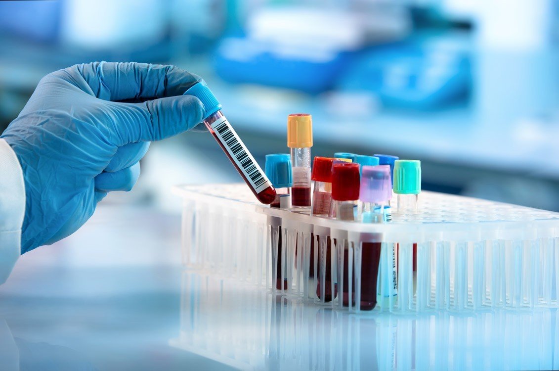 Cord Blood Testing and Banking - AlphaCord